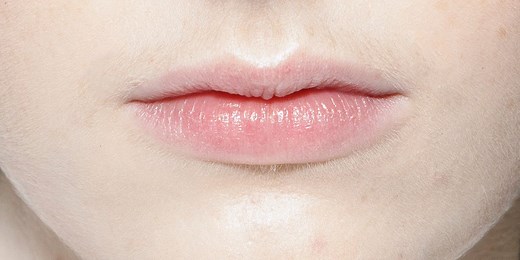 How to Heal Cracked Lip Corners Fast, According to Dermatologists