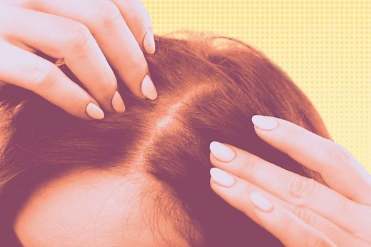 What Do Lice Look Like? Pictures and Symptoms