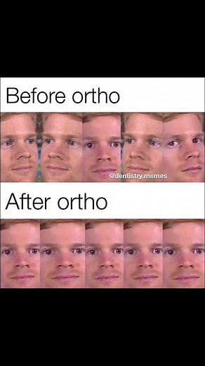 Dentistry memes on Instagram