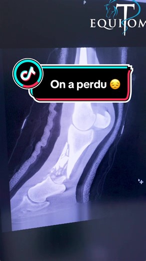 Fracture d’explosion chez un cheval : décision difficile