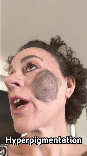 Hyperpigmentation #brainrot #funny #bananas #hyperpigmentation #memes #viral #fyp #viralvideo #why