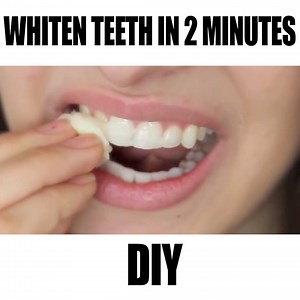 12K views · 134 reactions | How to Whiten Teeth in 2 Minutes! DIY  [guaranteed whiten teeth] | Rclbeauty101 | Facebook