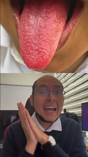 ¿Qué es la lengua de fresa?