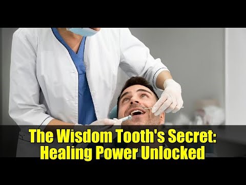 The Wisdom Tooth's Secret: Healing Power Unlocked
