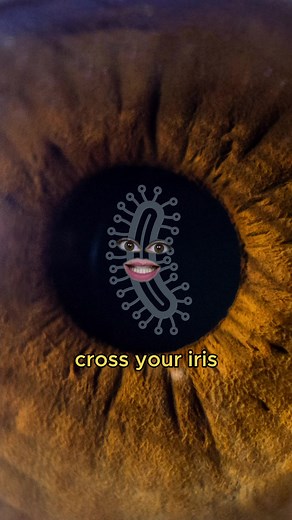 Eye Floaters Parody Musical | Dancing In The Moonlight