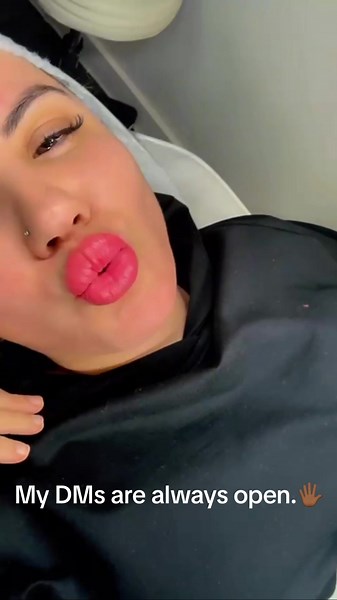 Lip blush is a semi-permanent cosmetic tattooing technique that enhances the natural color and shape of the lips💋…. #browartist #lipbalm #lipblush #lipblushtattoo #lipblushneutralization #lipneutralization #barbicanlondon #pmuartist #beautytips #beautyblogger #reeloftheday #reelsinstagram #tiktoklondon #whattodoinlondon #nailtech #makeupartist #makeuptutorial