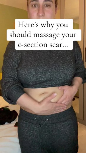 Effective C-Section Scar Massage Techniques Explained