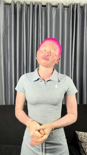 Nigerians please help me 😭🙏 am really struggling to build myself and albinism is after me 😭💔 please let’s repost 🙏🙏