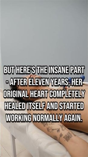 Teen lived with 2 hearts for 11 years then doctors removed one