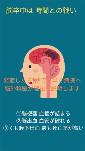 知っていますか？ 脳卒中