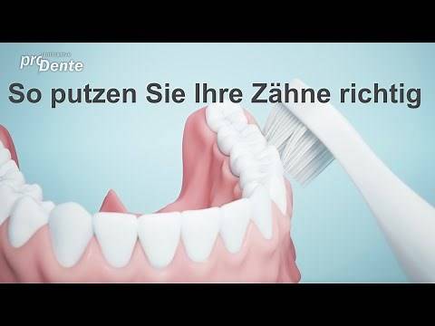 So putzen Sie ihre Zähne richtig