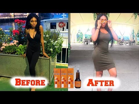 Apetamin Weight Gain Journey Before And After Pictures | Takisha Etienne