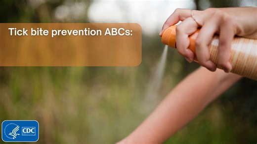 5.4K views · 130 reactions | Parents: Teach your kids the tick bite prevention ABCs! Learn more about preventing tick bites: https://bit.ly/3MYa6x1 | CDC | Facebook