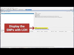 DNASTAR - Tracking loss of heterozygosity (LOH) in a human exome trio