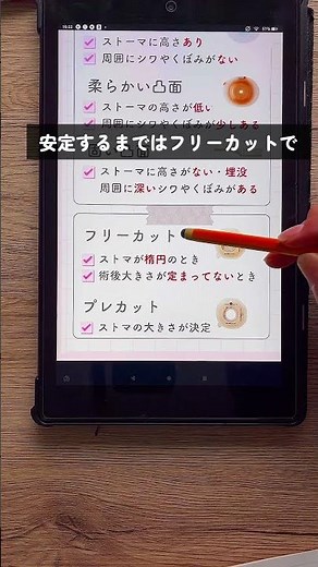【基本を押さえよう！ストーマ装具の選び方】#看護 #医療 #看護師2年目 #看護師 #看護師勉強垢 #新人看護師#ストーマ#ストマ #コロストミー #イレオストミー #便