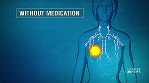 Breast cancer can “smolder” and return even 20 years later unless patients keep taking drugs with debilitating side effects to suppress it, researchers reported. http://nbcnews.to/2hm584u | NBC Nightly News with Tom Llamas