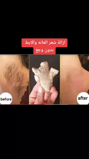 ازالة شعر العانة والابط بدون وجع بطريقة سهلة
