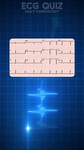 ECG quiz by Daily Cardiology | Daily Cardiology