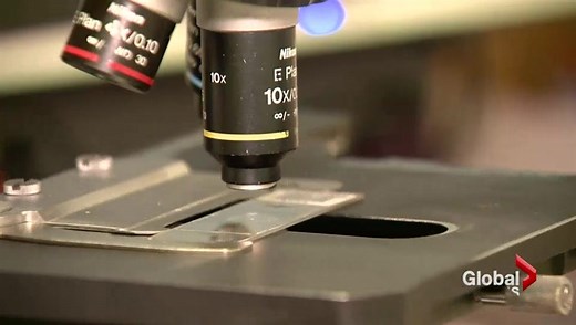 New information on cervical cancer screening for BC women