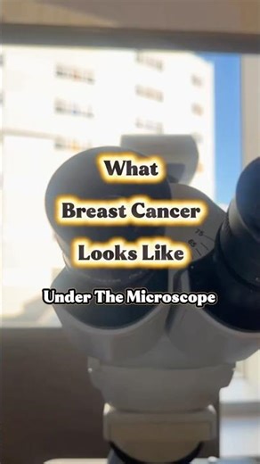 Normal cells versus cancer cells 🔬#breastcancer #cancer #underthemicroscope #cellbiology #health