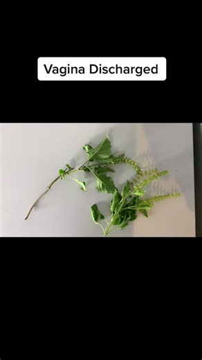 Understanding Vagina Discharge: Causes and Insights