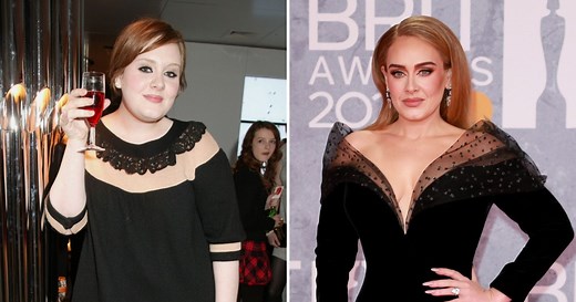 Did Adele Get Plastic Surgery? Transformation Photos