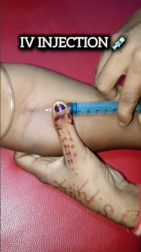 IV Injection kaise lagate hain 💉 | #iv #ivinjection #injection #shorts #mbbs #nurse #hospital #yt