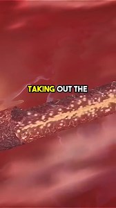 132K views · 1.5K reactions | Discover the Surprising Benefits of Dry Fasting – Challenge Yourself! Dry fasting isn’t for the faint-hearted, but the benefits might surprise you!  Ready to take your health to the next level? Learn what happens when you try dry fasting. #dryfasting #fastingbenefits #healthchallenge #biohacking #fypシ #wellnessjourney #detox #mindbody #healthtips #naturalhealing | Diet & healthy By Dr | Facebook