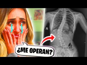BAD NEWS ABOUT MY SCOLIOSIS - Silvia Sánchez