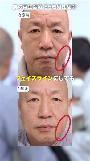 It's great that the changes are so natural.