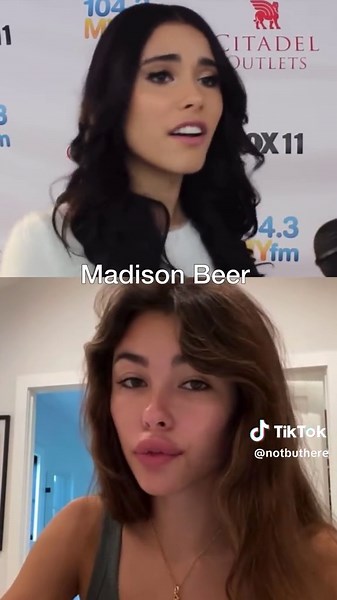 Madison Beer's Transformative Journey: Before and After Photos