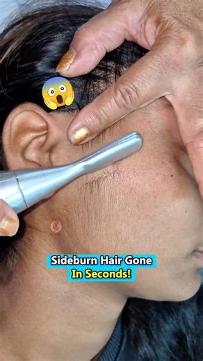 Sideburn Hair Removal with Trimmer | Clean Finish #facehair