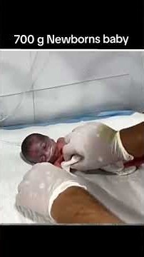 700g Baby Care Guide 🍼 Nursing Extremely Preterm Infants at 23 Weeks #baby #positivebirth #newborn