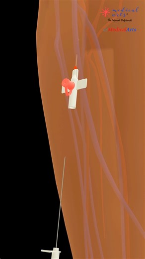 Medical on Instagram: "IV Insertion GONE WRONG 💀 | Hematoma & Vein Perforation Explained #medicalarts #HealthShorts #IVinsertion #NursingLife #Hematoma #MedicalFails #ScienceFacts #medstudent #nurse #doctors #medical #anatomy #physiologie #anatomie #accessoryorgans #medicine #health #nursing #nursingnotes #medicalnotes #nurses #nclex #usmlestep1 #nursingschool #medicalschool #nclexrn #studentnurse #medicalarts #anatomyphysiology"