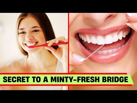 How to Clean Your Dental Bridges?