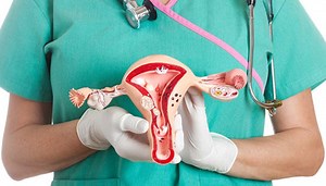 Hysterectomy