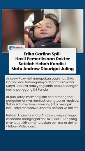 Andrew's Eye Condition After Being Suspected of Having a Lazy Eye, Erika Carlina Reveals Latest D...