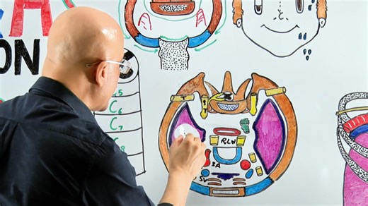 What are the differences between Pancoast Tumor and other Lung Carcinomas ? | Dr. Najeeb