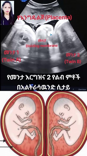 #ዶክተርሀረግ #drhareg