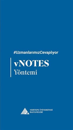 VNOTES Yöntemi