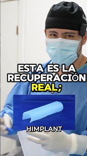 Así se recupera un HIMPLANT… Día a día 👀 (Completo en YouTube)