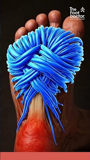 Still Confused About Plantar Fasciitis? Causes, Symptoms & Fix Explained (Foot Doctor Guide)