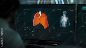 Doctor Diagnosing Lung Cancer By Using X-ray Scan Interface At Hospital. X-ray Scan System Analyzing Disease Cells For Medical Diagnosis. X-ray Scan Of Respiratory System. Illness Diagnosis