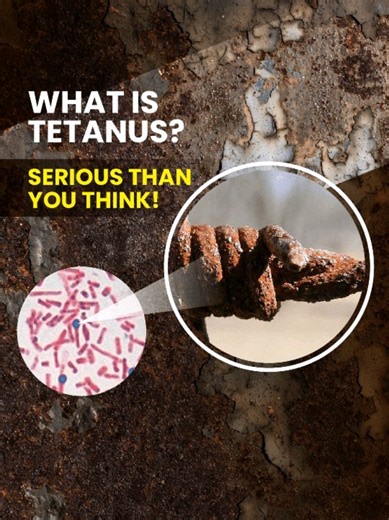Importance of Tetanus Vaccination for Everyone