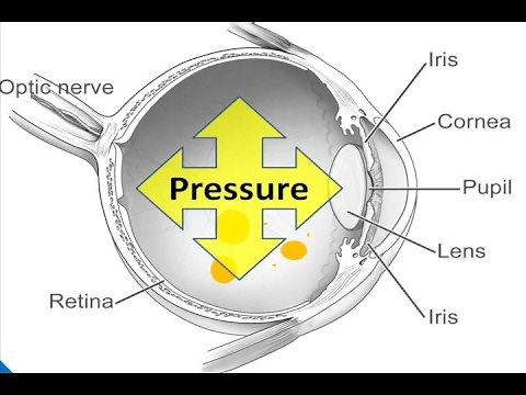 What is an Intravitreal Injection?