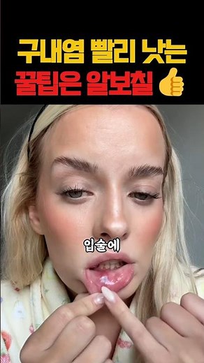 구내염 치료법? 🧂 소금, 라임, 파프리카… 직접 해봤다가 참교육 당함