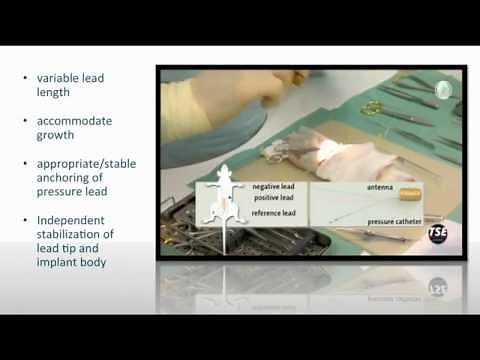 Freedom: The Promise of Telemetry Revisited - Stellar Telemetry Webinar (TSE Systems)
