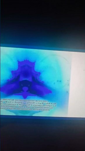 silver lining productions treehouse nelvana nickelodeon confusion invert color