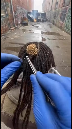 Ticks | Extreme tick infestation found. This video is for hygiene awareness and prevention only. Safe demonstration no medical advice. #ticks... | Instagram