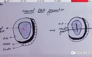 Development of the Eye part 1：Optic Cup formation - 眼的发育1：视杯的形成